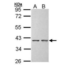 SGTA antibody from Signalway Antibody (22393) - Antibodies.com