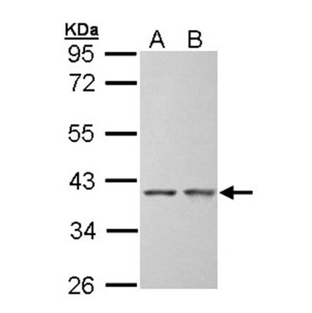 SGTA antibody from Signalway Antibody (22393) - Antibodies.com