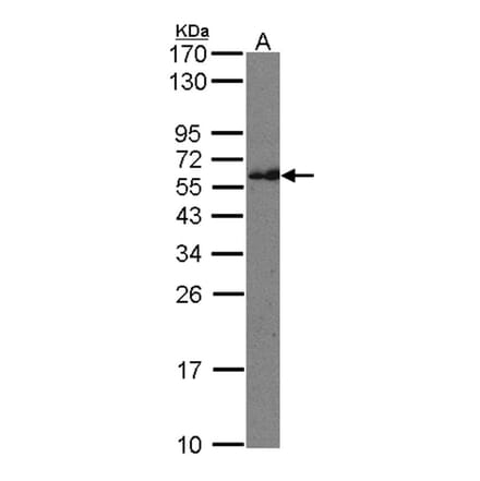 CMG1 antibody from Signalway Antibody (22421) - Antibodies.com