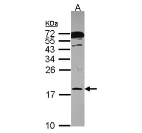 RPB8 antibody from Signalway Antibody (22443) - Antibodies.com