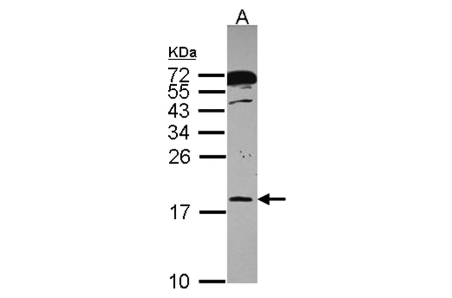RPB8 antibody from Signalway Antibody (22443) - Antibodies.com