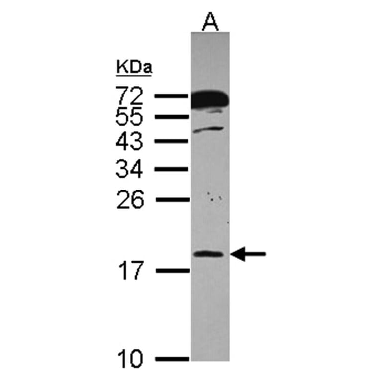 RPB8 antibody from Signalway Antibody (22443) - Antibodies.com