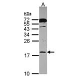 RPB8 antibody from Signalway Antibody (22443) - Antibodies.com