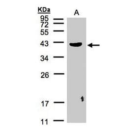 PLEK antibody from Signalway Antibody (22455) - Antibodies.com