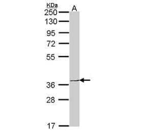 EDG6 antibody from Signalway Antibody (22466) - Antibodies.com