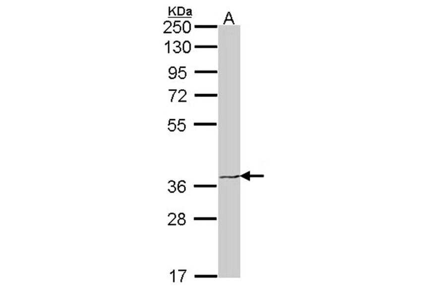 EDG6 antibody from Signalway Antibody (22466) - Antibodies.com