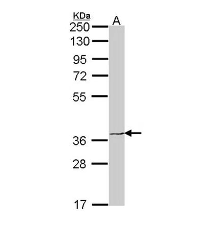 EDG6 antibody from Signalway Antibody (22466) - Antibodies.com