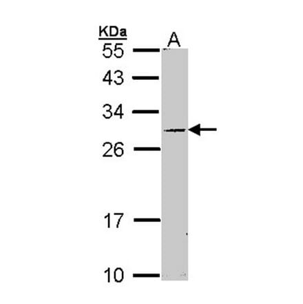 STAR antibody from Signalway Antibody (22510) - Antibodies.com
