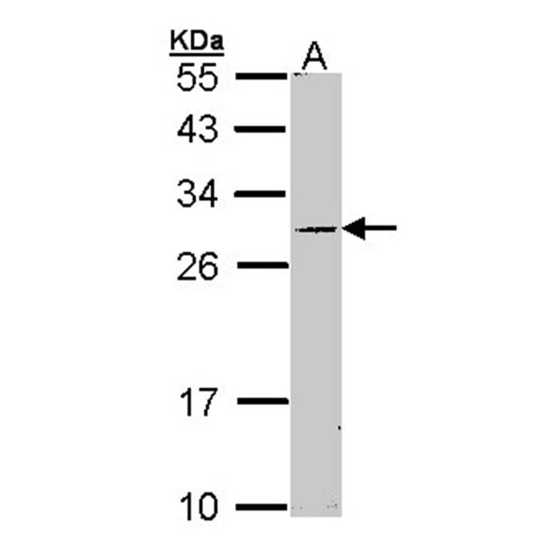 STAR antibody from Signalway Antibody (22510) - Antibodies.com