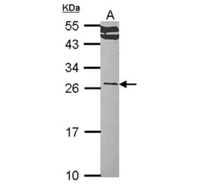 RALA antibody from Signalway Antibody (22525) - Antibodies.com