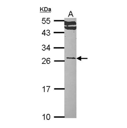 RALA antibody from Signalway Antibody (22525) - Antibodies.com