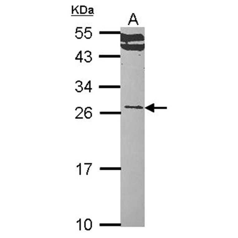 RALA antibody from Signalway Antibody (22525) - Antibodies.com
