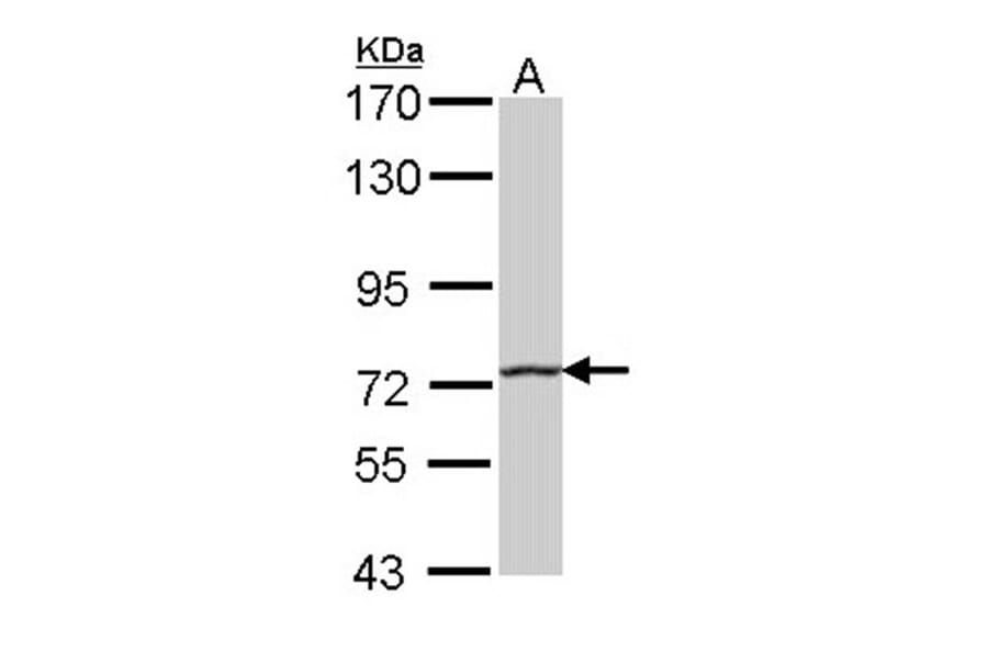 HHIP antibody from Signalway Antibody (22569) - Antibodies.com