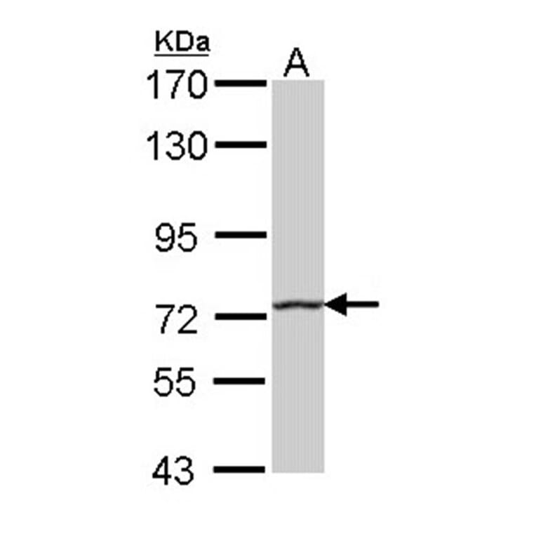 HHIP antibody from Signalway Antibody (22569) - Antibodies.com