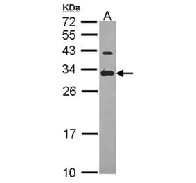 ING5 antibody from Signalway Antibody (22644) - Antibodies.com