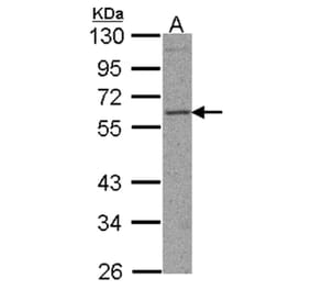 TFEB antibody from Signalway Antibody (22710) - Antibodies.com