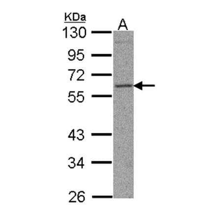 TFEB antibody from Signalway Antibody (22710) - Antibodies.com