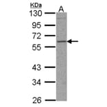 TFEB antibody from Signalway Antibody (22710) - Antibodies.com
