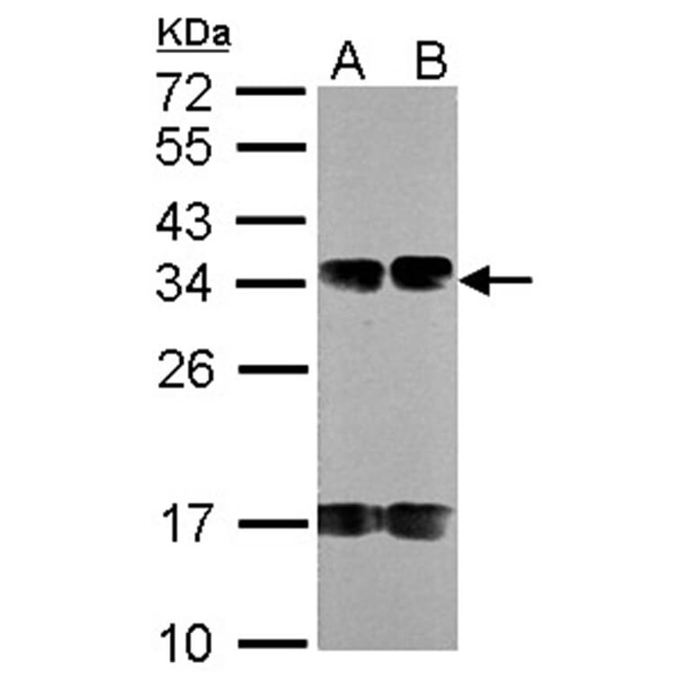 FUS2 antibody from Signalway Antibody (22721) - Antibodies.com