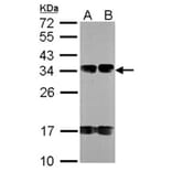 FUS2 antibody from Signalway Antibody (22721) - Antibodies.com