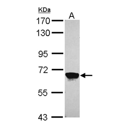 MPP2 antibody from Signalway Antibody (22724) - Antibodies.com