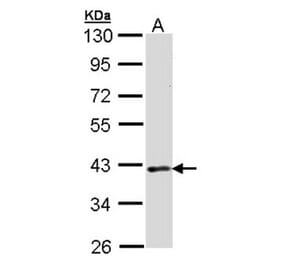 DMC1 antibody from Signalway Antibody (22903) - Antibodies.com