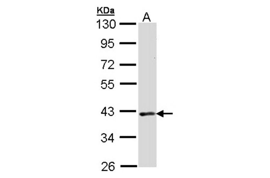 DMC1 antibody from Signalway Antibody (22903) - Antibodies.com