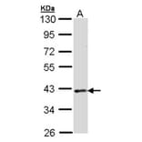 DMC1 antibody from Signalway Antibody (22903) - Antibodies.com