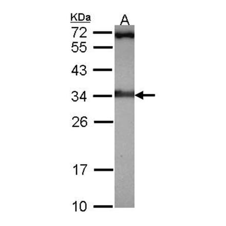 Rad1 antibody from Signalway Antibody (22948) - Antibodies.com