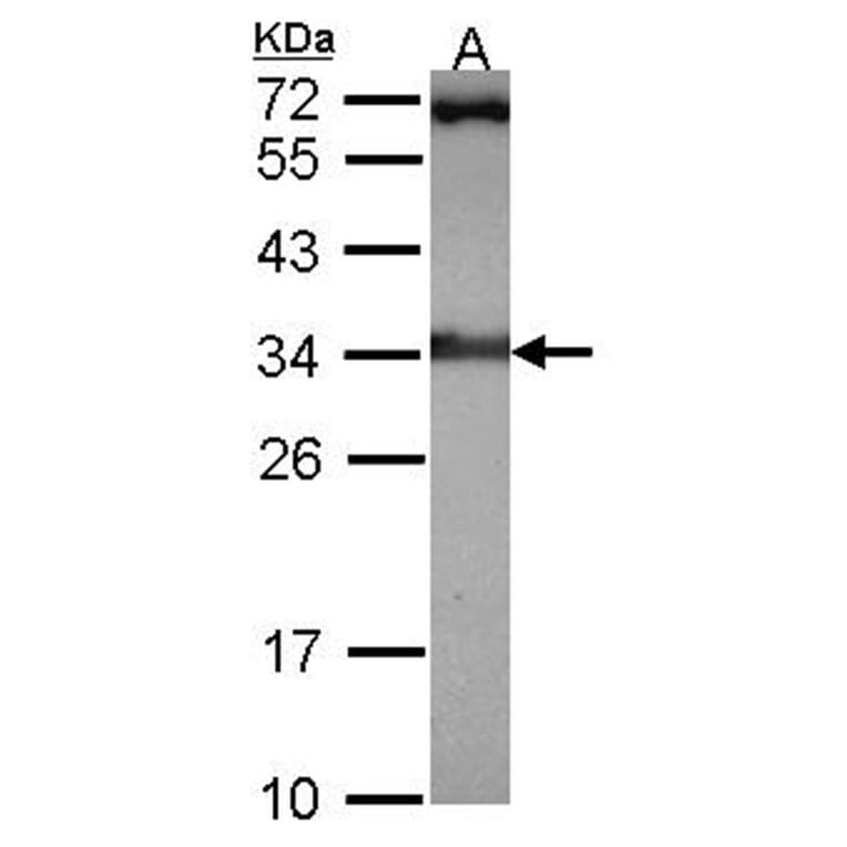 Rad1 antibody from Signalway Antibody (22948) - Antibodies.com