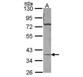 CA11 antibody from Signalway Antibody (22976) - Antibodies.com