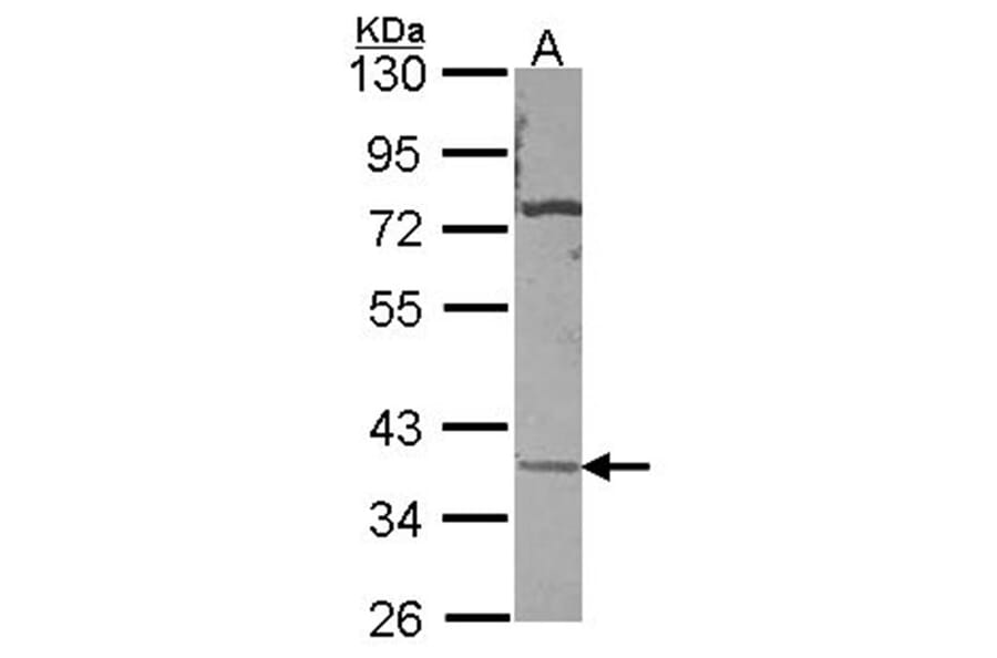 CA11 antibody from Signalway Antibody (22976) - Antibodies.com