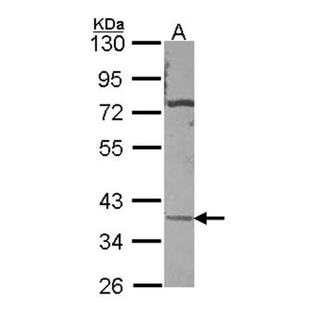 CA11 antibody from Signalway Antibody (22976) - Antibodies.com