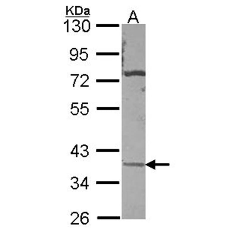 CA11 antibody from Signalway Antibody (22976) - Antibodies.com