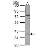 CA11 antibody from Signalway Antibody (22976) - Antibodies.com