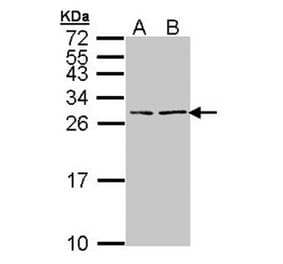 BNP antibody from Signalway Antibody (23046) - Antibodies.com
