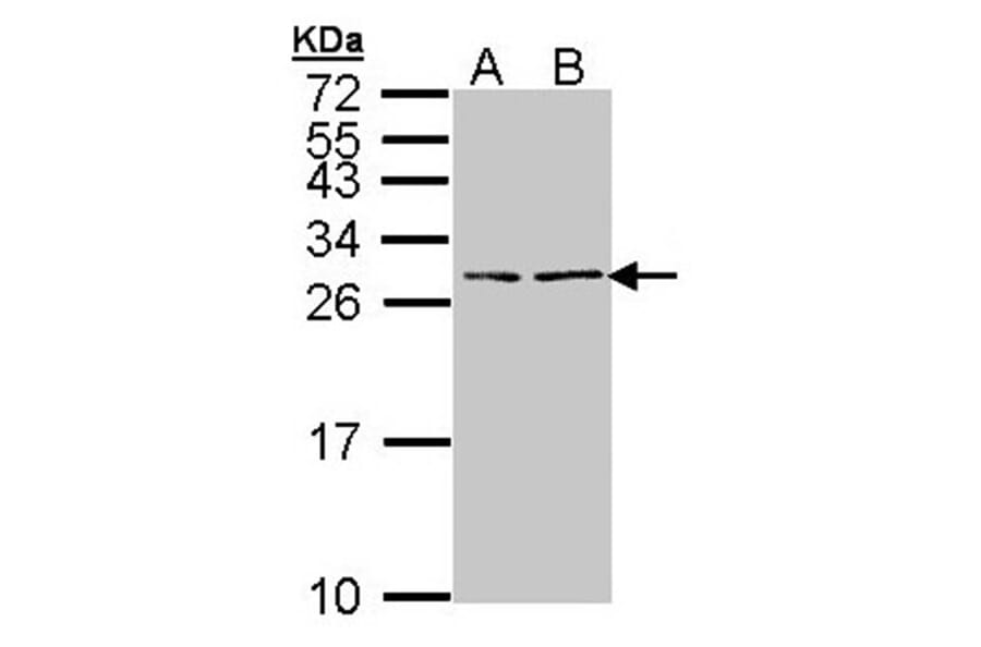 BNP antibody from Signalway Antibody (23046) - Antibodies.com