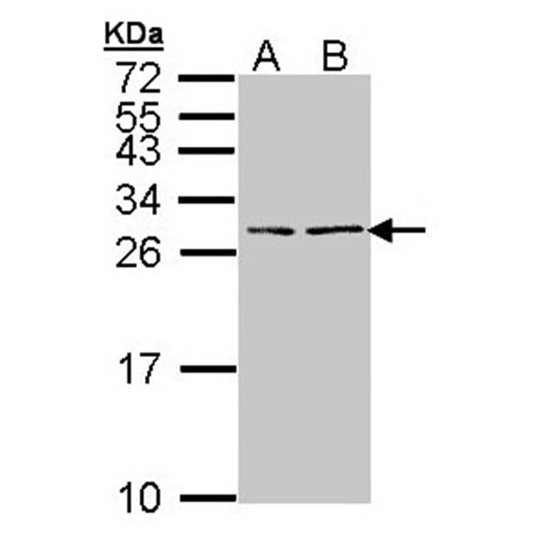 BNP antibody from Signalway Antibody (23046) - Antibodies.com