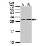 BNP antibody from Signalway Antibody (23046) - Antibodies.com