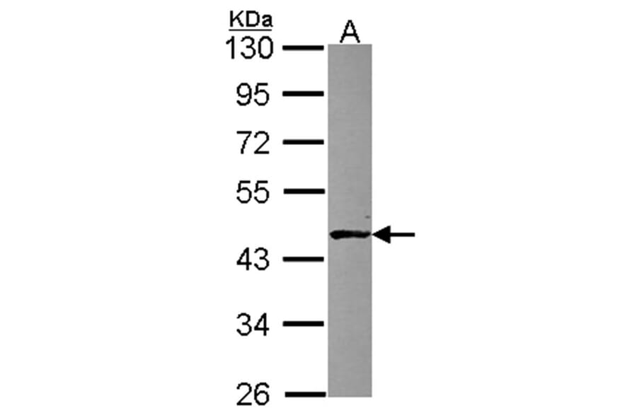 ABH1 antibody from Signalway Antibody (23093) - Antibodies.com