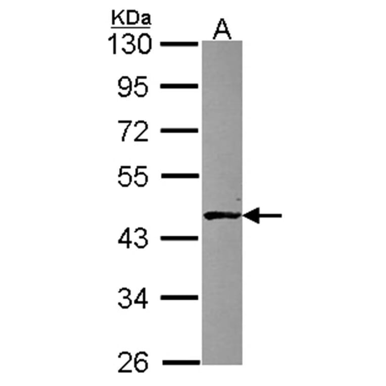 ABH1 antibody from Signalway Antibody (23093) - Antibodies.com