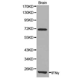 Western blot - IFNG Antibody from Signalway Antibody (32037) - Antibodies.com