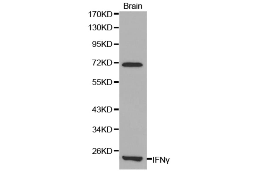 Western blot - IFNG Antibody from Signalway Antibody (32037) - Antibodies.com