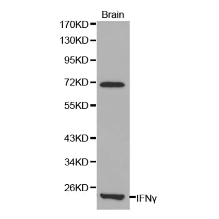 Western blot - IFNG Antibody from Signalway Antibody (32037) - Antibodies.com