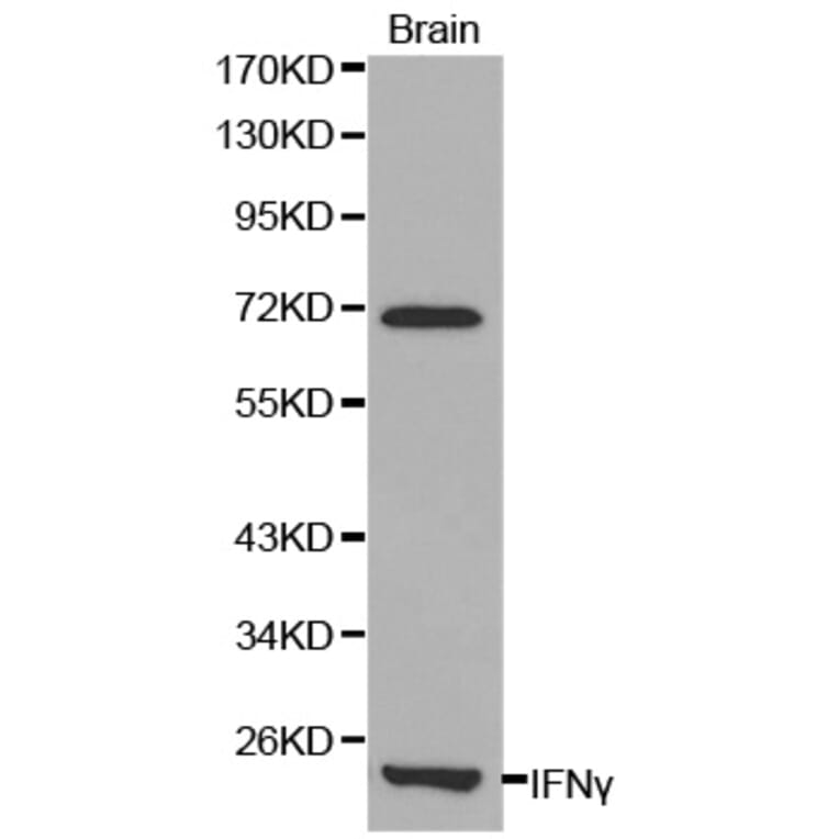 Western blot - IFNG Antibody from Signalway Antibody (32037) - Antibodies.com