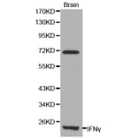Western blot - IFNG Antibody from Signalway Antibody (32037) - Antibodies.com