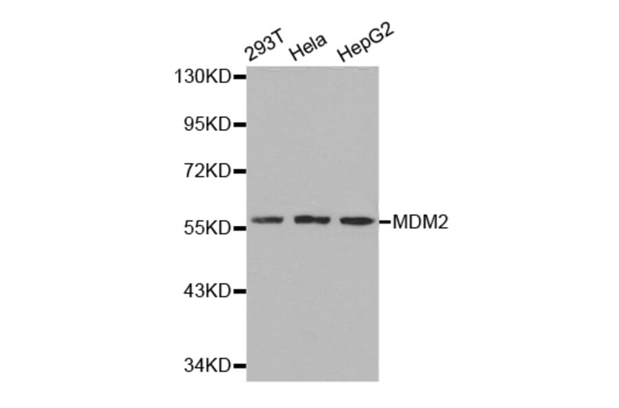Western blot - MDM2 Antibody from Signalway Antibody (32071) - Antibodies.com