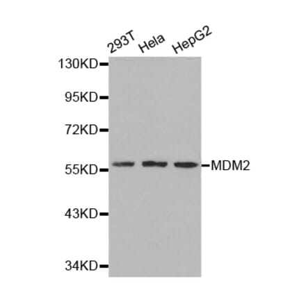 Western blot - MDM2 Antibody from Signalway Antibody (32071) - Antibodies.com