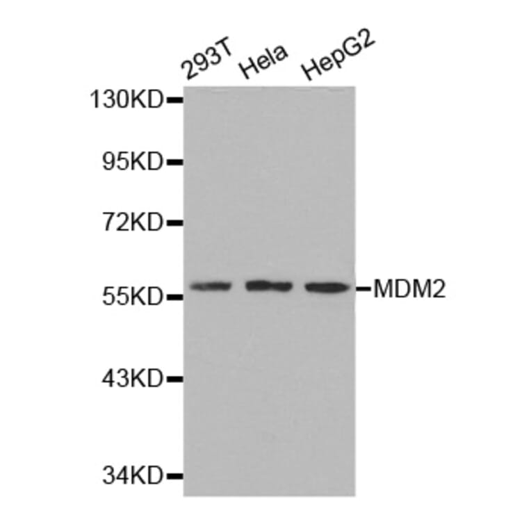 Western blot - MDM2 Antibody from Signalway Antibody (32071) - Antibodies.com