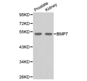 Western blot - BMP7 Antibody from Signalway Antibody (32087) - Antibodies.com